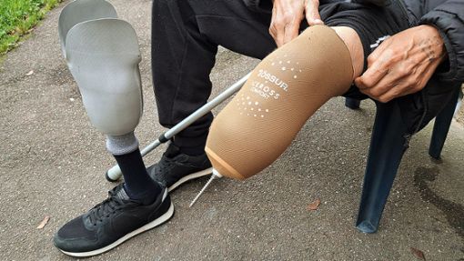 Ihr fehlt ein Arm, er hat ein Bein verloren